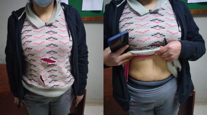 Tentativa de feminicidio: Sujeto intenta acuchillar a su expareja