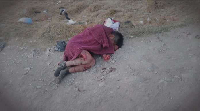 Perros casi devoran a hombre inconsciente