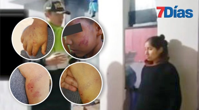 Madre golpea a su hijo de 5 años hasta causarle serias lesiones