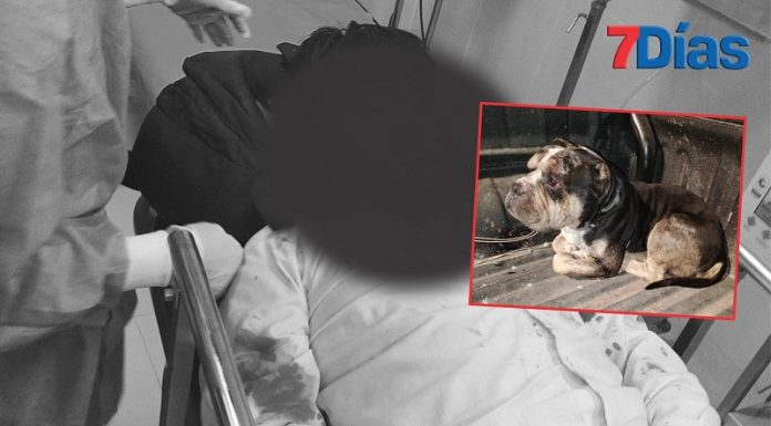 Perro pitbull ataca y muerde en el rostro a un menor de 11 años